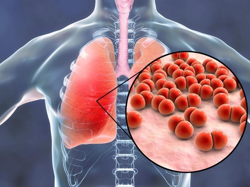 Painel Viral Essencial: Detecção Molecular de Patógenos Respiratórios por RT-PCR