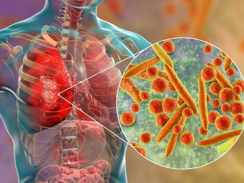 Exame de Mycoplasma pneumoniae por RT-PCR: Detecção Molecular Precisa